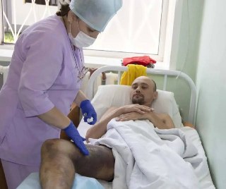 В Алтайском крае за лето зафиксировано 15 случаев укусов гадюк